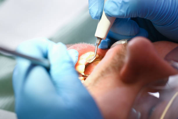 Best Cracked Tooth Emergency Dentist  in Hawkins, TX